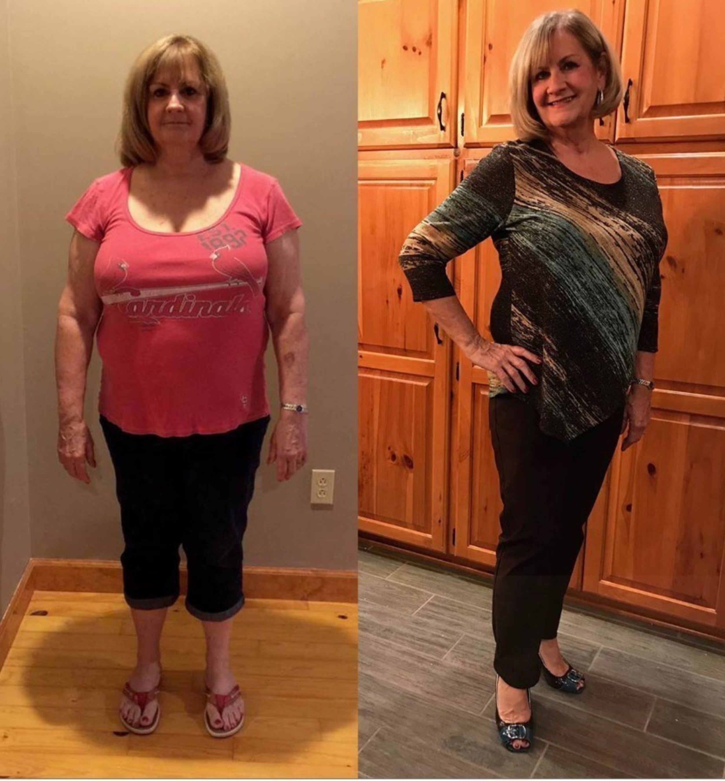 After diet and exercise failed, Andrea lost 50 pounds in just five months with ReShape.