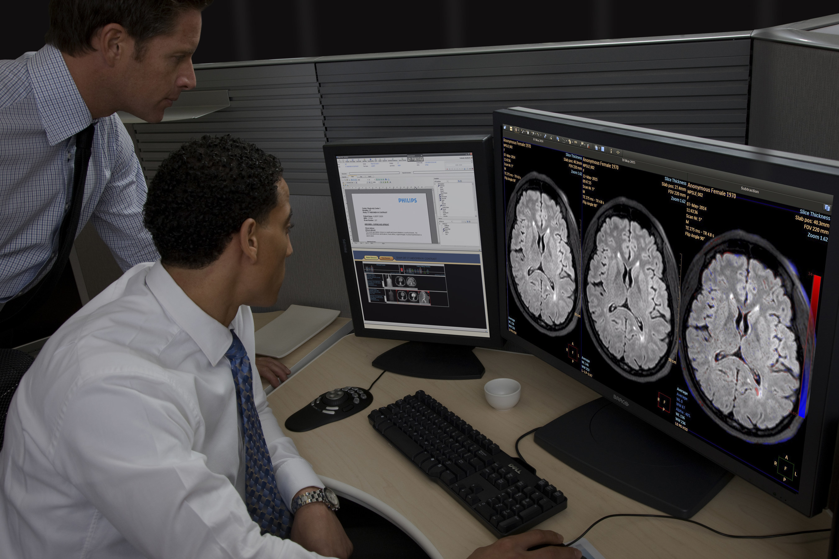 IntelliSpace Portal offers Longitudinal Brain Imaging (LoBI1*), an application that has beenoptimized for the interpretation of brain MRI scan and aims to facilitate the longitudinalevaluation of neurological disorders helping clinicians to monitor disease progression.*Pending 510(k), not available for sale in the United States.