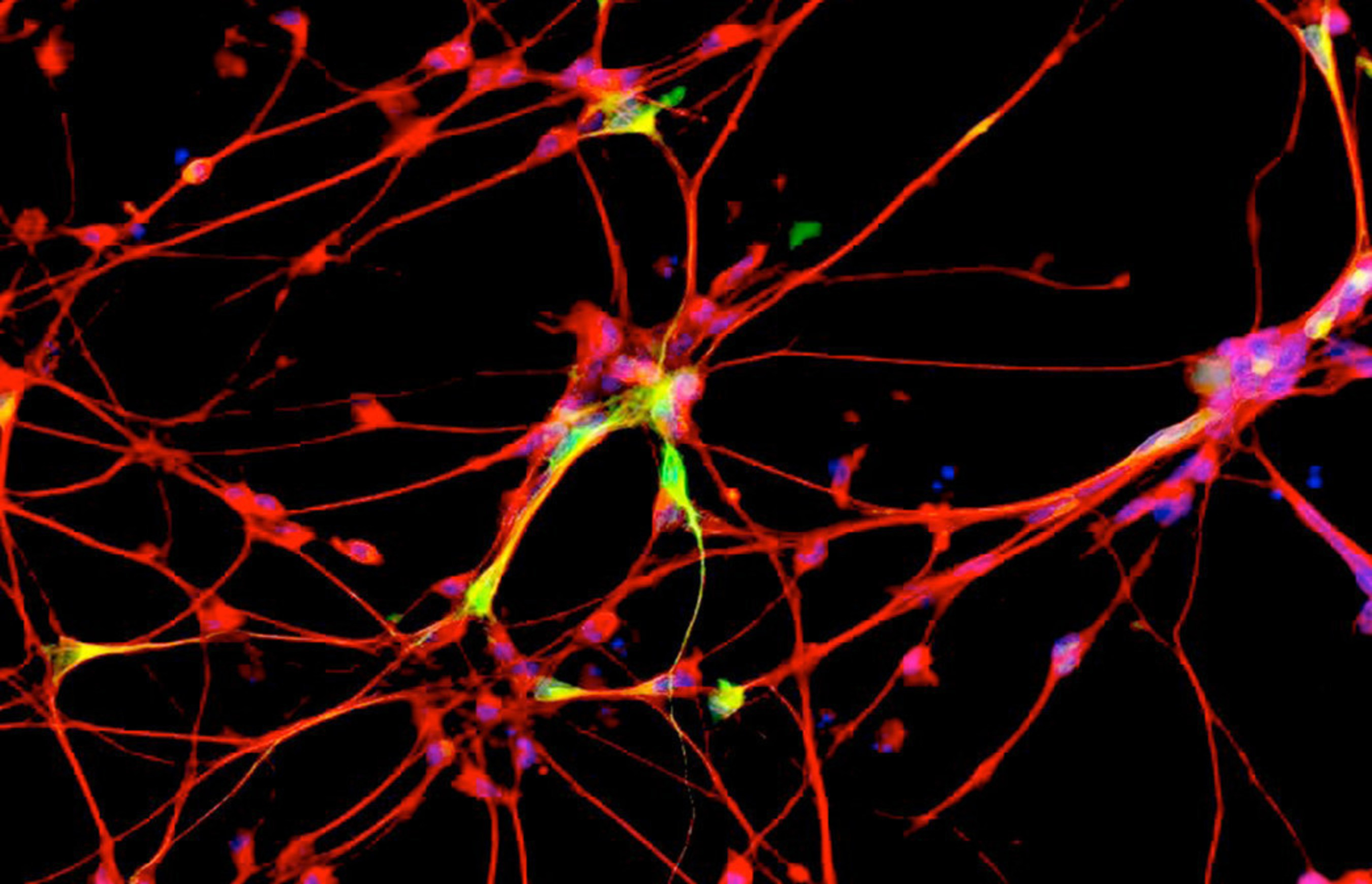 Dopamine-producing brain cells after treatment with MSDC-0160. Photo courtesy of the Patrik Brundin Laboratory, Van Andel Research Institute.