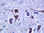 VENTANA MEDICAL SYSTEMS, INC. MOUSE BRAIN TISSUE  mRNA of Nav1.7, a sodium channel, expressed in normal mouse brain tissue detected by automated RNAscope XT assay. Single mRNA molecules (i.e. the individual dots of the hybridization signal) can be observed in the paraventricular hypothalamic nucleus on both neuronal cell bodies and dendrites. This image is taken with 100x objective lens.  (PRNewsFoto/Ventana Medical Systems, Inc.) TUCSON, AZ UNITED STATES 