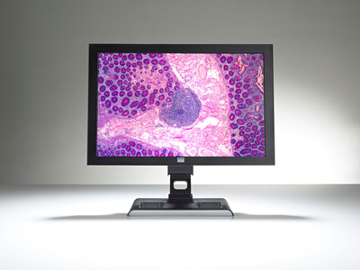 Ventana and Barco revolutionize digital pathology viewing experience with the Barco MDRC-2124.  (PRNewsFoto/Ventana Medical Systems, Inc.)