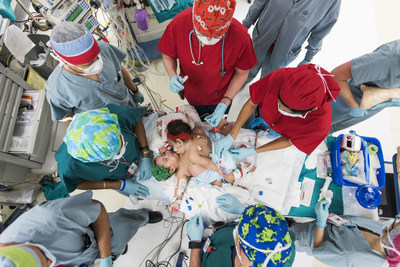 Surgeons and clinicians at Texas Children's Hospital prepare to separate conjoined twins Knatalye Hope and Adeline Faith Mata. Born in April 2014 at Texas Children's Pavilion for Women, the girls were successfully separated on Feb. 17, 2015 and are recovering in the Pediatric Intensive Care Unit at Texas Children's.