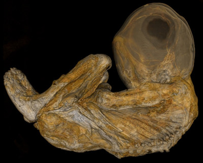 3D scan of child mummy at Cincinnati Children's