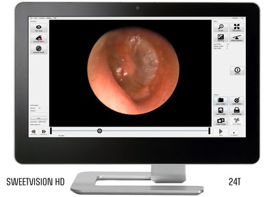 SweetVision HD 24T, endoscope imaging system - gui and eardrum shown