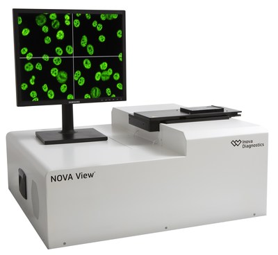 NOVA View automated digital IFA microscope