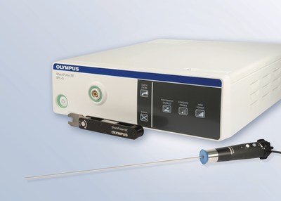 The ShockPulse-SE (Stone Eliminator) is Olympus' next-generation CyberWand for urological procedures. Energy is delivered via a revolutionary single probe design with surgeon controlled suction and integrated hand activation. The ShockPulse-SE boasts superior speed and efficiency for fragmenting and removing stones, and versatility offering a full range of probes and sizes for the kidney, ureter and bladder.
