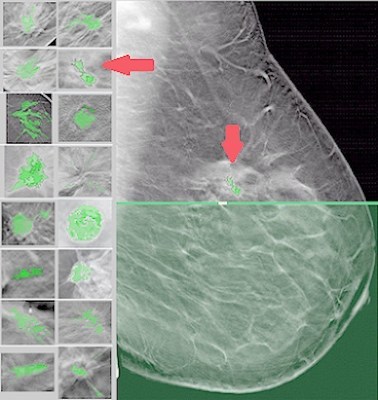Tissue Profile Scan Image