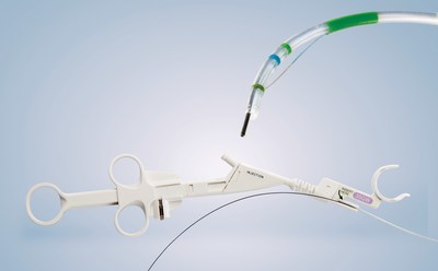 Olympus introduced today the 510(k) cleared CleverCut3V Distal Wireguided sphincterotome. CleverCut3V DW promotes safety and efficiency through advanced technology such as the CleverCut coating, which insulates the proximal portion of the cutting wire, helping to prevent such tissue damage and associated complications such as perforation.