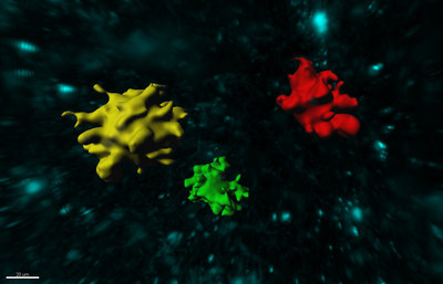 3 Dimensional Rendering of three amyloid plaques