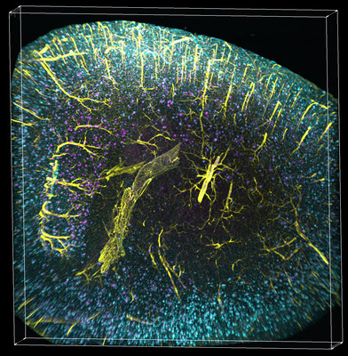 Triple label of vasculature, microglia, and plaques