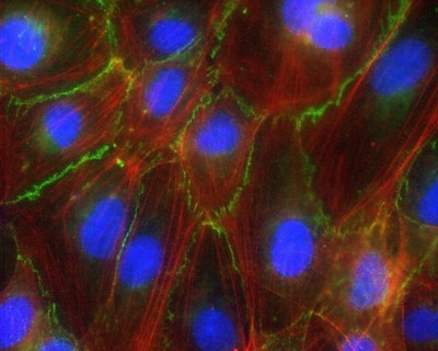 Pictured here is layer of cells lining a blood vessel, with each cell's nucleus in blue and protein skeleton in red. Between the cells in green is the protein beta catenin, part of a complex that lets cells cling tightly to each other to prevent blood from seeping out.