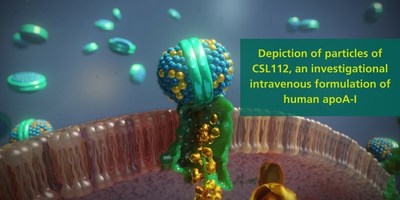 Depiction of particles of CSL112, an investigational intravenous formulation of human apoA-I.