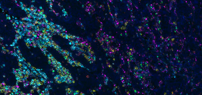 Lung tissue at 40x magnification using the DISCOVERY 5-Plex procedure